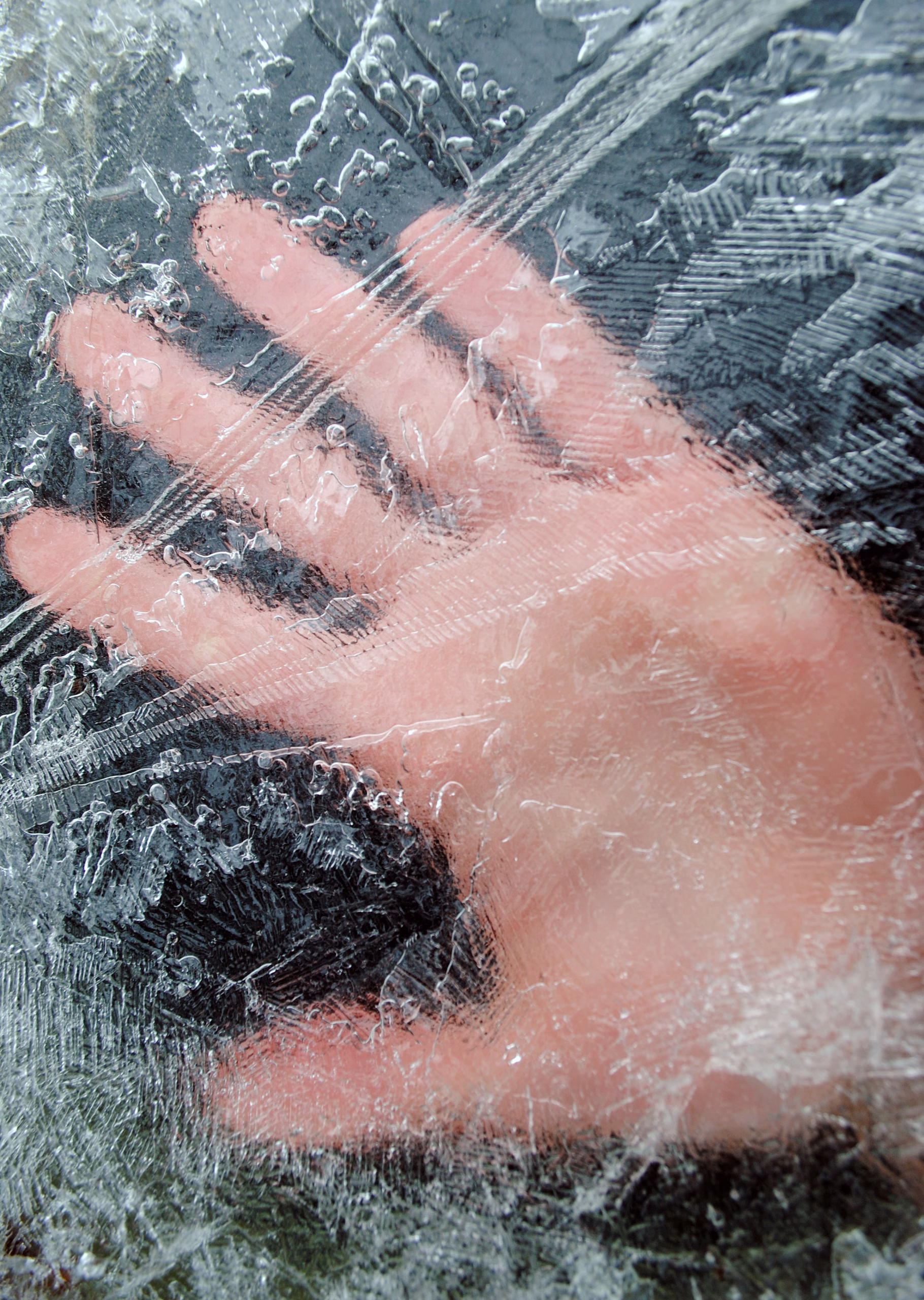 Hand,Under,A,Layer,Of,Ice.,Man,Under,The,Ice. hypothermie et engelures, FIMUQ