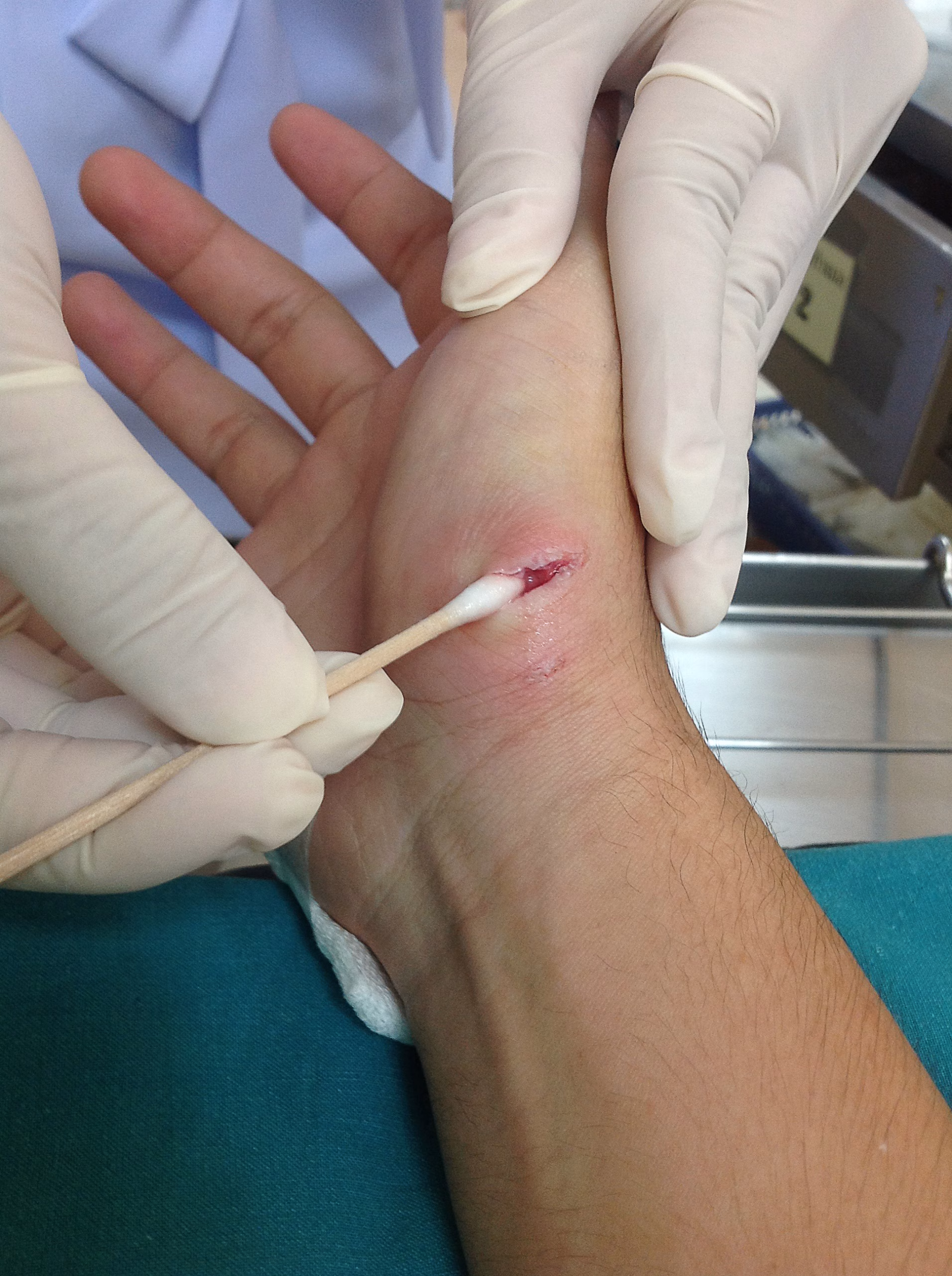 blessures coupures et hémorragies, FIMUQ
